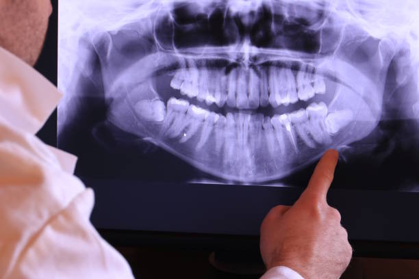 Best Emergency Tooth Extraction in West Brattleboro, VT